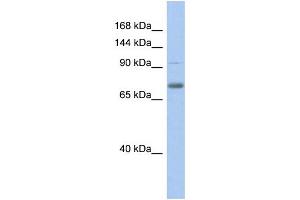 WB Suggested Anti-ZKSCAN5 Antibody Titration:  0. (ZKSCAN5 antibody  (N-Term))