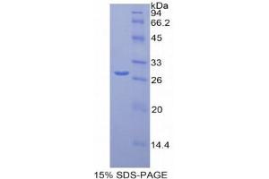 SDS-PAGE (SDS) image for Melanoma Cell Adhesion Molecule (MCAM) (AA 324-565) protein (His tag) (ABIN1877504)