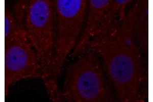 Immunofluorescence staining of methanol-fixed Hela cells, using Phospho-SNCA-Y133 antibody. (SNCA antibody  (pTyr133))