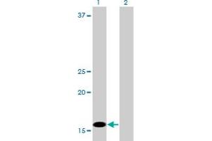 Western Blotting (WB) image for anti-C1D Nuclear Receptor Corepressor (C1D) (AA 1-142) antibody (ABIN599137)
