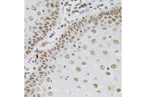 Immunohistochemistry of paraffin-embedded human esophagus using TGM2 antibody (ABIN5970369) (40x lens). (Transglutaminase 2 antibody)