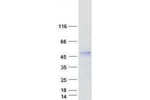 Western Blotting (WB) image for Hemochromatosis (HFE) (Transcript Variant 1) protein (Myc-DYKDDDDK Tag) (ABIN2722684)