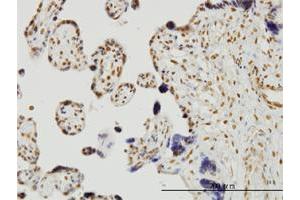 Immunoperoxidase of monoclonal antibody to RUNX2 on formalin-fixed paraffin-embedded human placenta. (RUNX2 antibody  (AA 251-350))