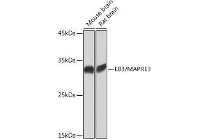 Western blot analysis of extracts of various cell lines, using EB3/M Rabbit mAb (ABIN7268535) at 1:1000 dilution. (MAPRE3 antibody)