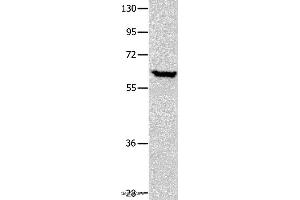 Western blot analysis of Human seminoma tissue, using DNAJC7 Polyclonal Antibody at dilution of 1:400