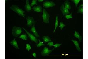 Immunofluorescence (IF) image for anti-Eukaryotic Translation Initiation Factor 4 Gamma, 1 (EIF4G1) (AA 1500-1599) antibody (ABIN515213)