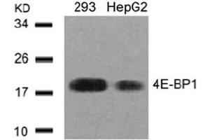 Image no. 3 for anti-Eukaryotic Translation Initiation Factor 4E Binding Protein 1 (EIF4EBP1) (AA 43-47) antibody (ABIN197452) (eIF4EBP1 antibody  (AA 43-47))