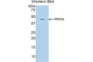 Detection of Recombinant C3a, Mouse using Polyclonal Antibody to Complement Component 3a (C3a) (C3a antibody  (AA 671-748))