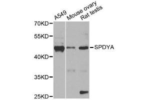 Western blot analysis of extracts of various cell lines, using SPDYA antibody.