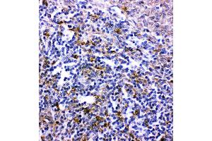 Anti- CXCR6 antibody, IHC(P): Rat Spleen Tissue (CXCR6 antibody  (C-Term))