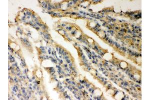 Anti- Rad51 Picoband antibody, IHC(P) IHC(P): Rat Intestine Tissue (RAD51 antibody  (AA 1-258))