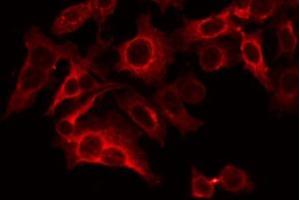 ABIN6266638 staining LOVO by IF/ICC. (Synaptophysin antibody  (Internal Region))