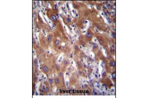GNE Antibody (N-term) (ABIN656219 and ABIN2845536) immunohistochemistry analysis in formalin fixed and paraffin embedded human liver tissue followed by peroxidase conjugation of the secondary antibody and DAB staining. (GNE antibody  (N-Term))