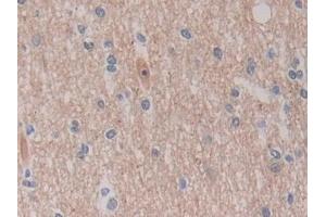 Detection of ROS1 in Human Cerebrum Tissue using Polyclonal Antibody to C-Ros Oncogene 1, Receptor Tyrosine Kinase (ROS1) (ROS1 antibody  (AA 1945-2222))