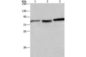 Western Blot analysis of Mouse brain tissue, A172 and Hela cell using DBH Polyclonal Antibody at dilution of 1:200 (DBH antibody)