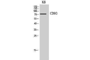 Western Blotting (WB) image for anti-CD93 (CD93) (Internal Region) antibody (ABIN3178943) (CD93 antibody  (Internal Region))