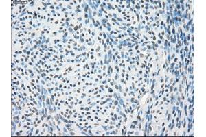 Immunohistochemical staining of paraffin-embedded Kidney tissue using anti-PPP5Cmouse monoclonal antibody.