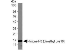 Western Blotting (WB) image for anti-Histone 3 (H3) (H3K18me2) antibody (ABIN5706755)