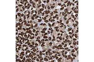 Immunohistochemical staining of human stomach with XKR3 polyclonal antibody  shows strong cytoplasmic positivity(granular pattern) in parietal cells at 1:50-1:200 dilution. (XKR3 antibody)