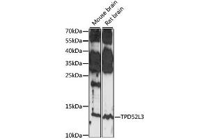 Western blot analysis of extracts of various cell lines, using TPD52L3 antibody (ABIN7271079) at 1:1000 dilution. (TPD52L3 antibody  (AA 1-132))