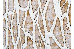 IHC analysis of Cofilin-2 using anti-Cofilin-2 antibody (ABIN7602747). (Cofilin 2 antibody  (C-Term))