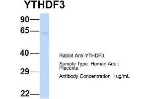 Host: Rabbit  Target Name: YTHDF3  Sample Tissue: Human Adult Placenta  Antibody Dilution: 1. (YTHDF3 antibody  (N-Term))
