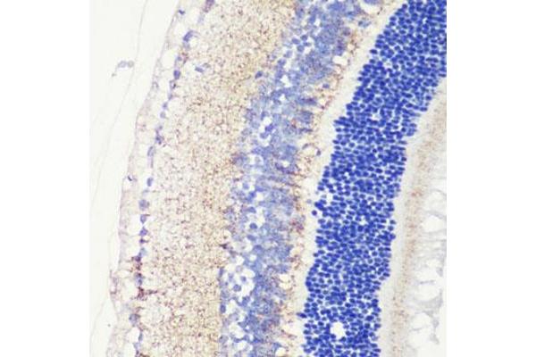 CRB1 antibody  (AA 20-200)