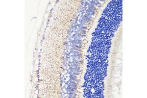Immunohistochemistry of paraffin-embedded mouse retina using CRB1 antibody (ABIN7266524) at dilution of 1:200 (40x lens).