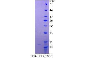 Image no. 1 for MYC Associated Factor X (MAX) (AA 2-160) protein (His tag,GST tag) (ABIN6237222) (MAX Protein (AA 2-160) (His tag,GST tag))