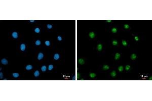 ICC/IF Image c-Myc antibody detects c-Myc protein at nucleus by immunofluorescent analysis. (c-MYC antibody  (Center))