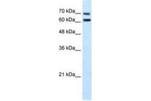 Image no. 2 for anti-Family with Sequence Similarity 55, Member D (FAM55D) (AA 407-456) antibody (ABIN205071) (FAM55D antibody  (AA 407-456))