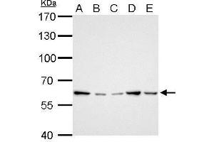 WB Image GGT1 antibody detects GGT1 protein by Western blot analysis. (GGT1 antibody)