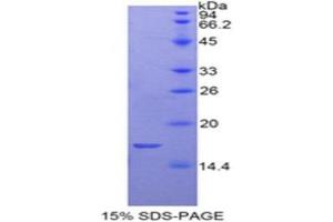SDS-PAGE (SDS) image for Glycoprotein Ib (Platelet), beta Polypeptide (GP1BB) (AA 52-164) protein (His tag) (ABIN1879569) (GP1BB Protein (AA 52-164) (His tag))