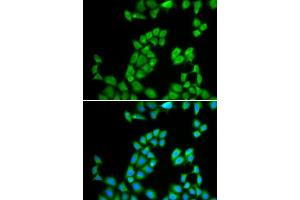 Immunofluorescence analysis of MCF-7 cell using RNASE13 antibody. (RNASE13 antibody  (AA 1-156))