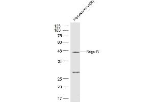 Rat Hippocampus lysates probed with Nogo Receptor Polyclonal Antibody, Unconjugated  at 1:500 dilution and 4˚C overnight incubation. (RTN4R antibody  (AA 151-350))