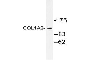 Western blot (WB) analysis of COL1A2 antibody in extracts from 293 cells. (COL1A2 antibody  (Chain alpha 2))