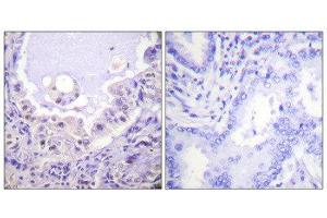 Immunohistochemistry (IHC) image for anti-V-Raf-1 Murine Leukemia Viral Oncogene Homolog 1 (RAF1) (Ser621) antibody (ABIN1847970) (RAF1 antibody  (Ser621))