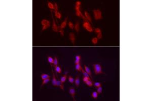 Immunofluorescence analysis of PC-12 cells using /GSNOR Rabbit pAb (ABIN6131172, ABIN6136579, ABIN6136580 and ABIN6217464) at dilution of 1:50 (40x lens). (ADH5 antibody  (AA 1-374))