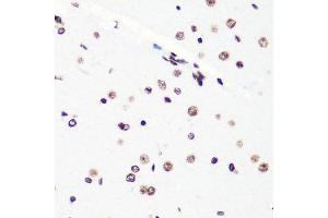 Immunohistochemistry of paraffin-embedded mouse brain using H4K20me2 antibody. (Histone H4 antibody  (2meLys20))