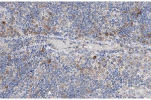 ABIN6266950 at 1/100 staining human lymph node tissue sections by IHC-P.