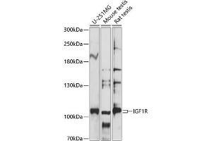 Western blot analysis of extracts of various cell lines, using IGF1R antibody (ABIN7267898) at 1:1000 dilution. (IGF1R antibody  (AA 741-910))