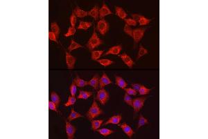 Immunofluorescence analysis of NIH/3T3 cells using HK3 Rabbit pAb (ABIN6131756, ABIN6141801, ABIN6141802 and ABIN6224488) at dilution of 1:150 (40x lens). (HK3 antibody  (AA 1-270))