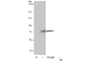 Immunoprecipitation (IP) image for anti-Matrix Metalloproteinase 2 (MMP2) antibody (ABIN2855854)