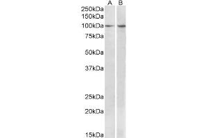ABIN1590037 (1 µg/mL) staining of MCF7 (A) and Human Breast cancer (B) lysates (35 µg protein in RIPA buffer). (BCAR1 antibody  (Internal Region))