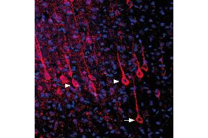 Expression of P2RY6 in rat parietal cortex - Immunohistochemical staining of perfusion-fixed frozen rat brain sections with Anti-P2Y6 Receptor (extracellular) Antibody (ABIN7043591, ABIN7045140 and ABIN7045141), (1:1000), followed by donkey-anti-rabbit-biotin and streptavidin-Cy3. (P2RY6 antibody  (2nd Extracellular Loop))