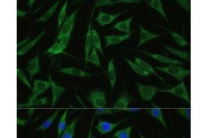 Immunofluorescence analysis of L929 cells using RHBDD1 Polyclonal Antibody at dilution of 1:100 (40x lens). (RHBDD1 antibody)