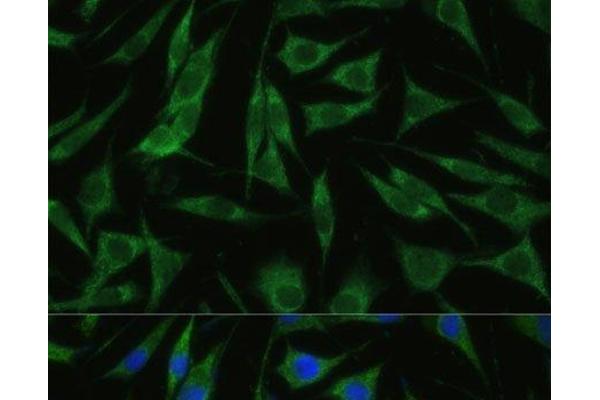 RHBDD1 antibody