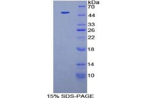 SDS-PAGE analysis of Human FGF6 Protein.