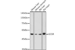 Glucagon Receptor Antikörper  (AA 1-140)