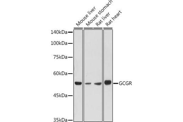 Glucagon Receptor 抗体  (AA 1-140)